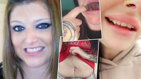 I was left with ‘bulldog face’ for tummy & 7 TEETH fell out after using fat jabs…but it was all worth it for 1 reason