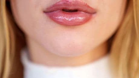 Fat injections and Brazilian butt lifts ‘offered in public toilets’, experts say