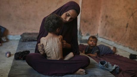 Aumentan a 100 los niños muertos por desnutrición en Gaza desde el inicio de la ofensiva israelí