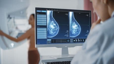 Tumori: cresce l’adesione agli screening,  ma al Sud i test faticano a decollare