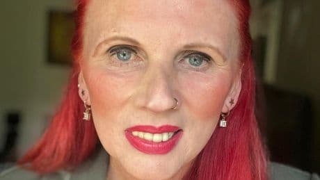 Single mother landed with 20% rent increase calls for rent controls