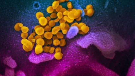 La OMS pone bajo vigilancia una nueva variante de coronavirus: NB.1.8.1