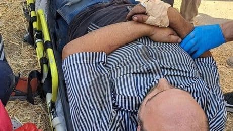 Yem karma makinesine düşen işçi yaralandı