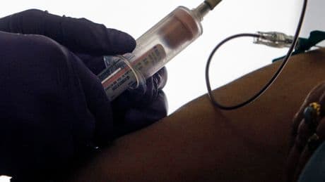 Breast Cancer Patients Get Early Warning of Faltering Drugs With Blood Test