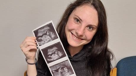 Medizinisches Wunder - Ihr Baby wächst in einer halben Gebärmutter