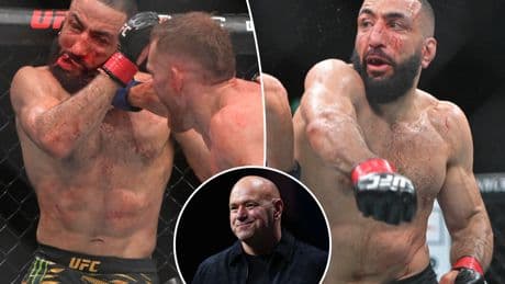 Dana White shows off Belal Muhammad’s horrifying UFC injury in gruesome photo