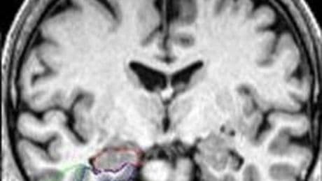 Natural compound found in popular hot drink could protect brain against Alzheimer’s, study finds