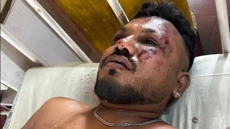 British man survives plane crash