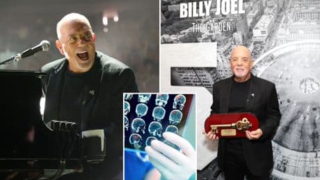 What is normal pressure hydrocephalus (NPH)? All about the brain condition affecting Billy Joel