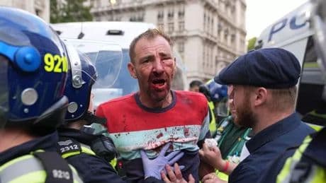 Far-right thugs left bloodied after police clashes during Tommy Robinson protest - in pictures