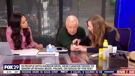 TV host discovers he has skin cancer during live on-air broadcast