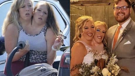 Abby e Brittany Hensel: le gemelle siamesi diventano mamme, ma chi è la madre biologica?