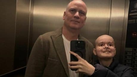 Julio Sergio, il figlio dell'ex portiere della Roma in coma irreversibile: Enzo, 10 anni, è malato di tumore