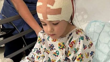 'My girl, 5, had quarter of her brain removed - it was only way to save her'