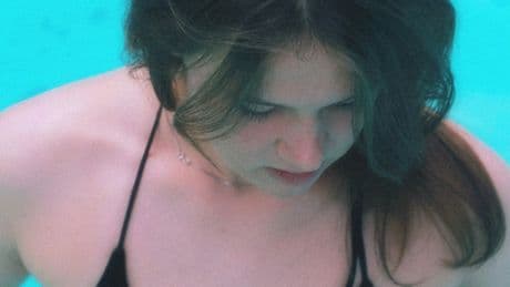 I'm A Dermatologist – Here's How To Get To Sleep With A Sunburn