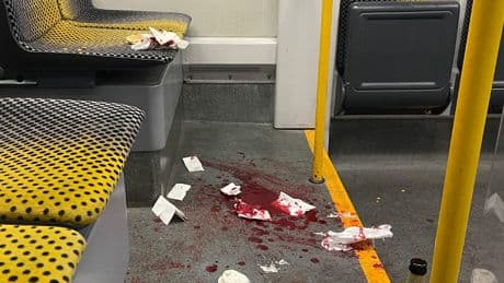 Messerangriff auf US-Bürger in Dresden - „Bloody hell“! Entsetzen auch in Amerikas Medien