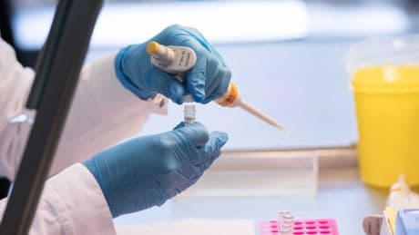 In vielen Ländern erlaubt: Bayern und Baden-Württemberg drängen auf Erweiterung der DNA-Analyse