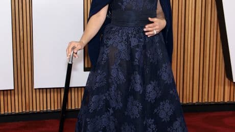 Selma Blair reveals the MS symptoms doctors dismissed since she was a kid: ‘It took me 30 years to get an MRI’