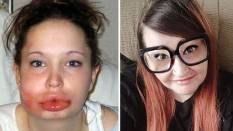 'I was hospitalised because of my addiction - I want people to take it seriously'