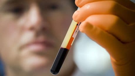 Uitslag Stelling: ’Reguliere PSA-check nodig’