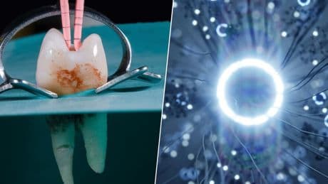 Hemos desarrollado un implante dental que parece sacado de 'Blade Runner': crece y es capaz de 'hackear' el cerebro