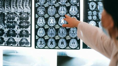 Este es el órgano que afecta a tu cerebro más de lo que imaginas (y puedes cuidarlo desde hoy)