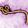 Einsatzkräfte müssen ausrücken: Mann in Tschechien könnte mit Ebola infiziert sein