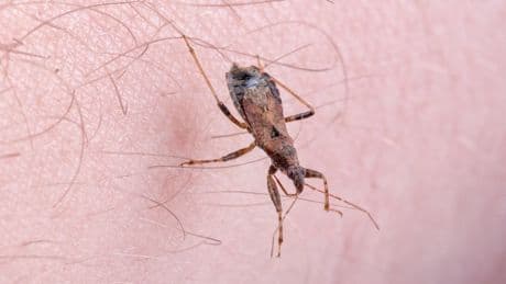 Mapped: Where deadly ‘kissing bug’ disease Chagas has spread in the US