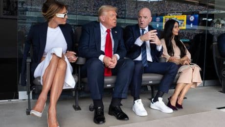 Donald Trump: Daher kommen Schwellungen und blaue Flecken