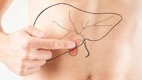 ¿Nueva terapia para la enfermedad hepática crónica más prevalente?