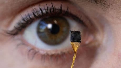 Bu beyin implantı, iç düşünceleri konuşmaya dönüştürebilir