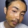 Man contracts horrific skin disease after common shopping mistake