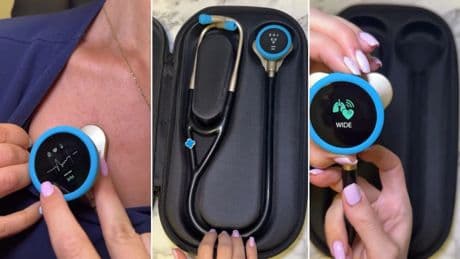 Desarrollan un estetoscopio con IA capaz de detectar enfermedades cardiacas en solo 15 segundos