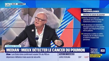 French Tech : Median, mieux détecter le cancer du poumon - 14/05