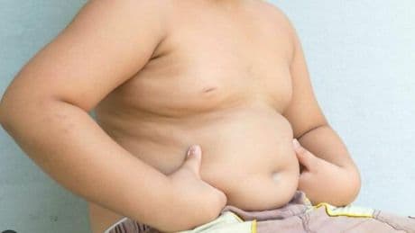 Troppi cibi pronti: allarme bimbi obesi. Peso sul Pil per 13 miliardi