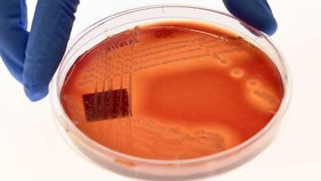 Foreign aid cuts could lead to millions more dying from superbug infections by 2050, study warns