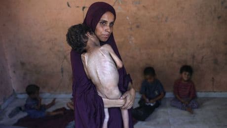 De honger in Gaza is zo groot, dat voor velen hulp niet meer op tijd zal komen