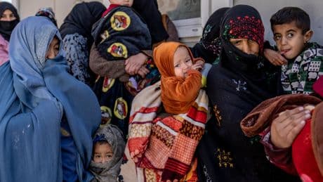 Afghanistan has its 'sharpest surge' ever of child malnutrition, UN agency says
