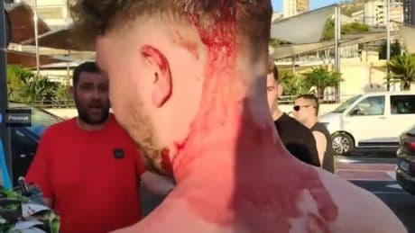 Dark side of Benidorm where Brits are attacked by ‘wolf-like’ gangs of bouncers… what holidaymakers MUST do to stay safe
