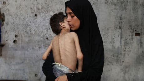 Hungersnot im Gazastreifen: „Zum Sterben zu viel, zum Leben zu wenig“