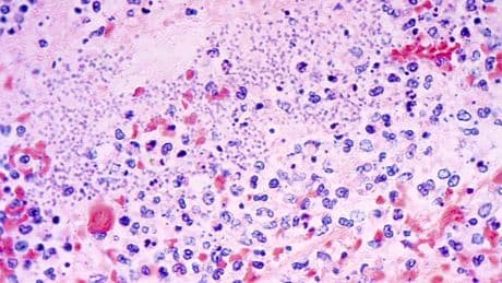 A Person in Arizona Has Died From Plague. Who’s Most at Risk of Contracting It, and How Can You Protect Yourself?