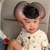 Parents of boy cruelly nicknamed 'Mickey Mouse' over giant growths caused by treatment for rare skin condition share their joy as he makes amazing transformation