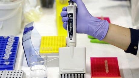 Una infección en la infancia, posible causa del aumento del cáncer de colon en jóvenes