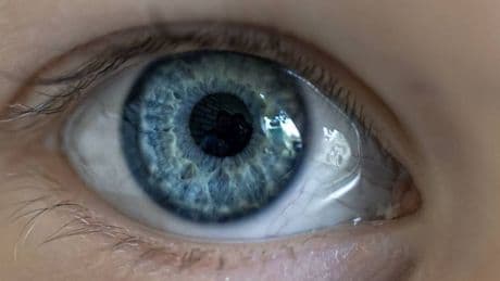 Fotografían la retina y descubren cómo diagnosticar con IA a 500.000 niños (solo) en España