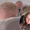 Woman shares hilarious video of a 'Turkish hairlines' flight full of post-op men