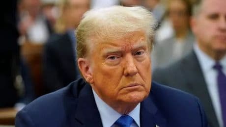 Fox News halted as Donald Trump diagnosed with serious health condition amid concerning bruises