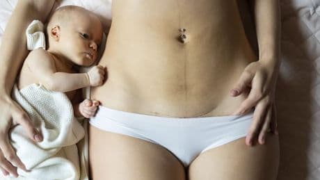 „Bei rund zehn Prozent der Frauen liegt ein Kopf-Becken-Missverhältnis vor“