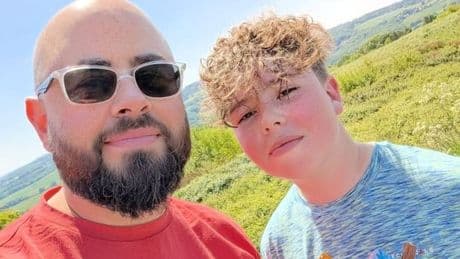 Dad's fury as son suffers severe burns after 'frying in 30C heat on school trip'