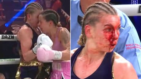 ‘Horrendous’ – Moment boxer Terri Harper clashes heads with Natalie Zimmerman to leaves her with horror ‘blood mask’