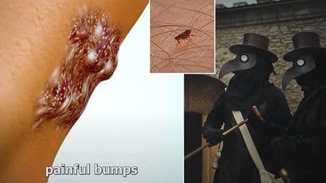 Gruesome simulation reveals what 'the black death' does to the body - as American patient tests positive for plague